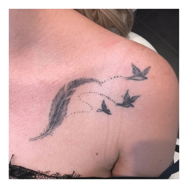 tattoo laseren amsterdam schouder before