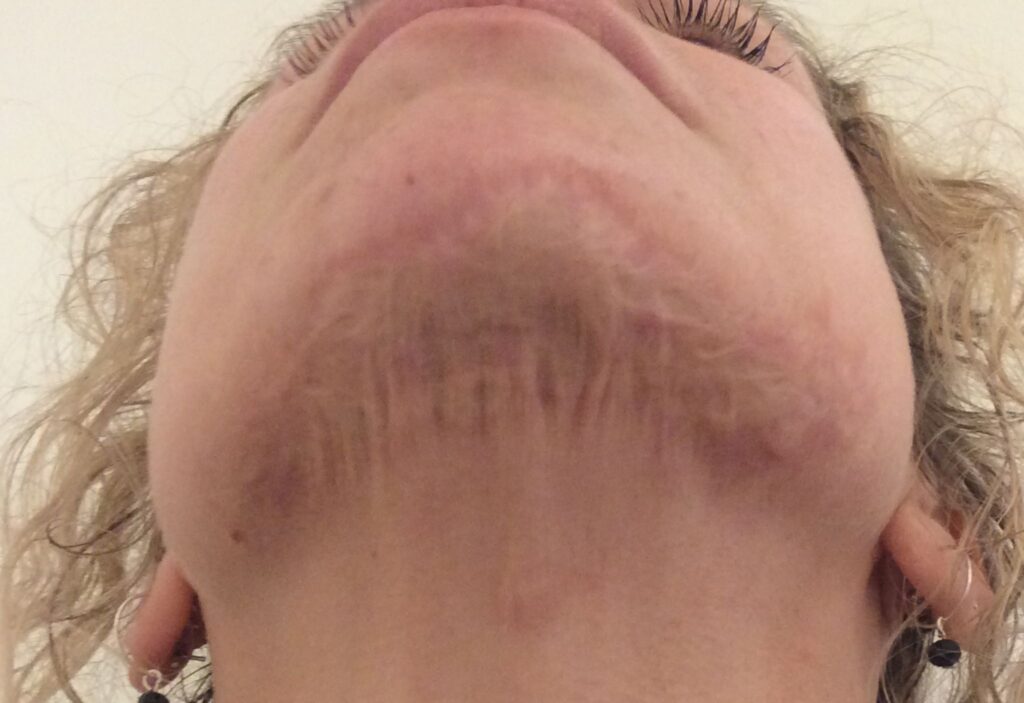 xr:d:DAE8dLwqX3Y:22,j:31694462409,t:22072814