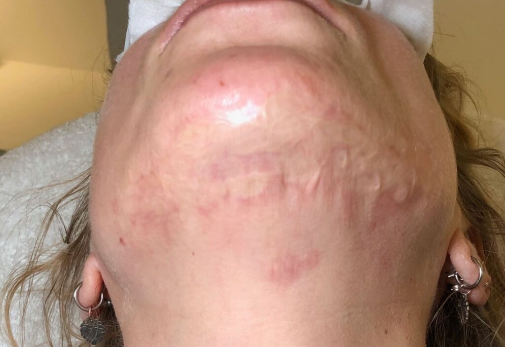 xr:d:DAE8dLwqX3Y:22,j:31694462409,t:22072814