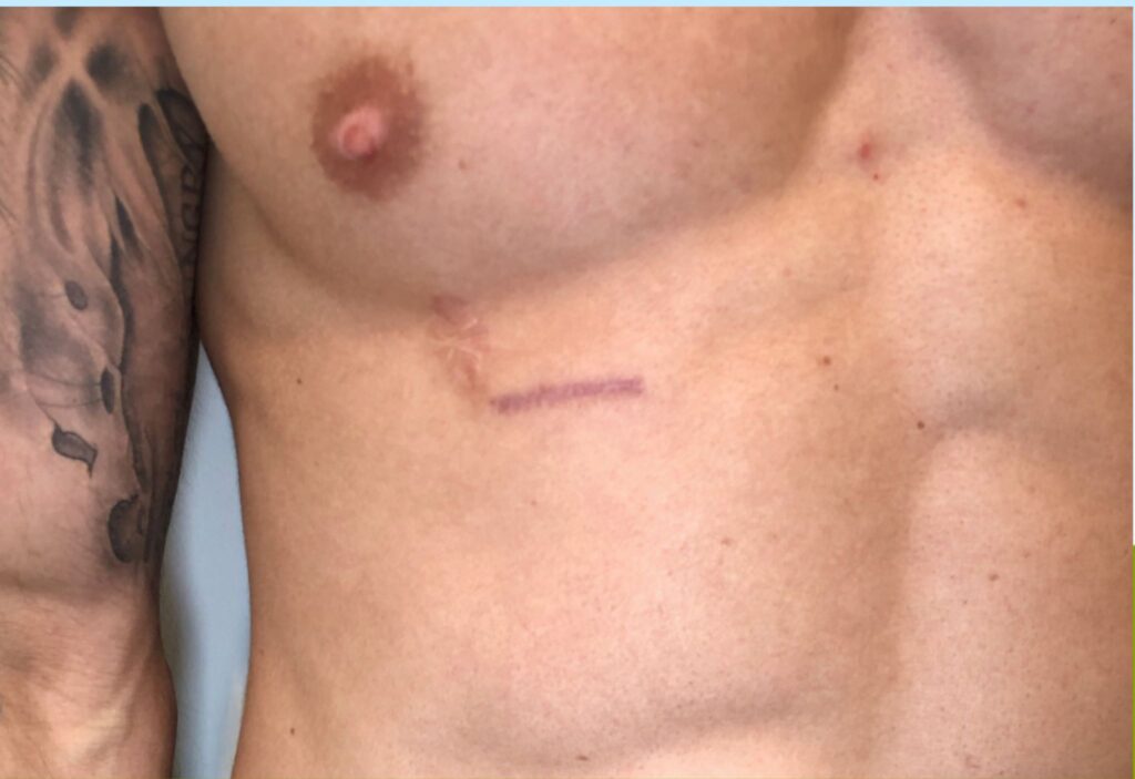 xr:d:DAE8dLwqX3Y:22,j:31694462409,t:22072814