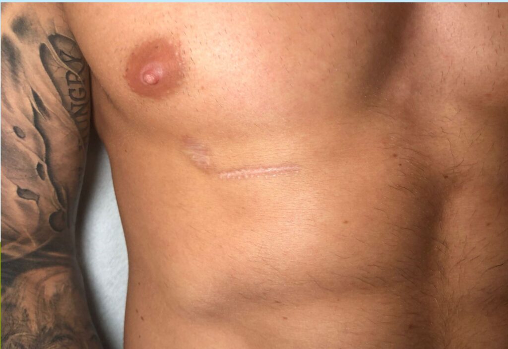 xr:d:DAE8dLwqX3Y:22,j:31694462409,t:22072814